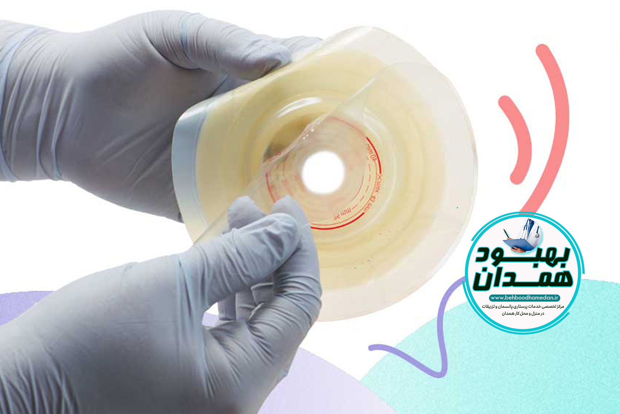 استوما چیست و چرا نیاز به مراقبت دارد؟