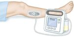 دستگاه وکیوم تراپی زخم مدل Simplex II