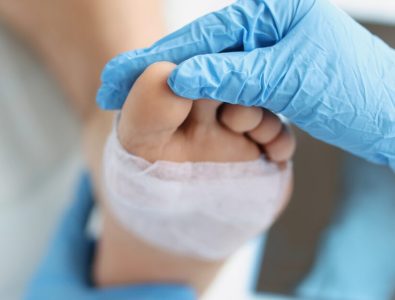 خدمات تخصصی پانسمان زخم در همدان