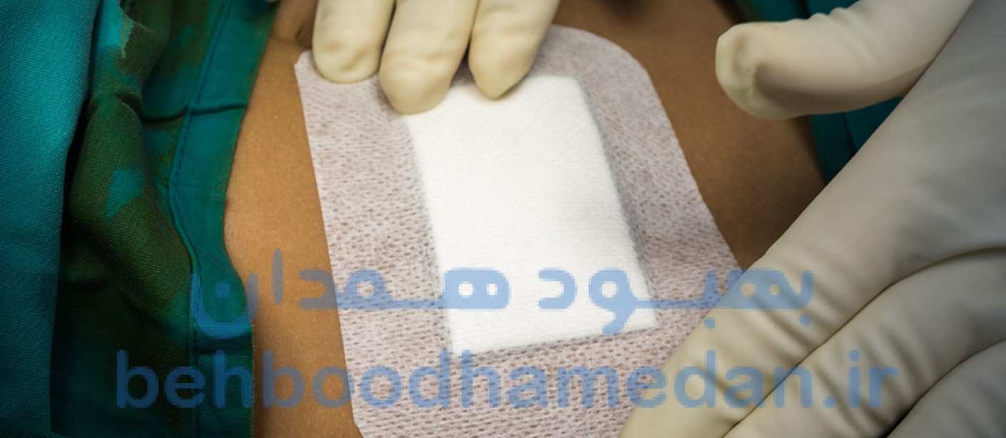 پانسمان پس از جراحی در همدان